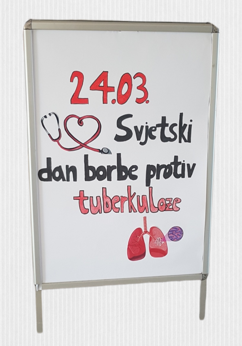 TBC